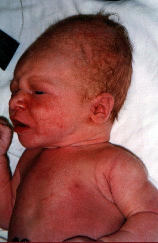 First picture!